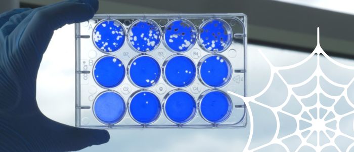 Gloved hand holding a blue-stained 12‑well laboratory plate with visible cell colonies.